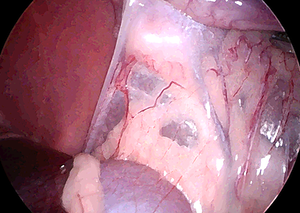 犬の腹腔鏡下避妊手術の体腔内