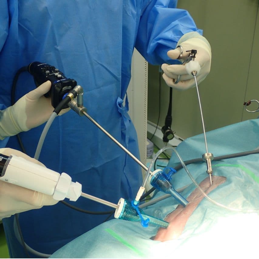 腹腔鏡手術の手術風景