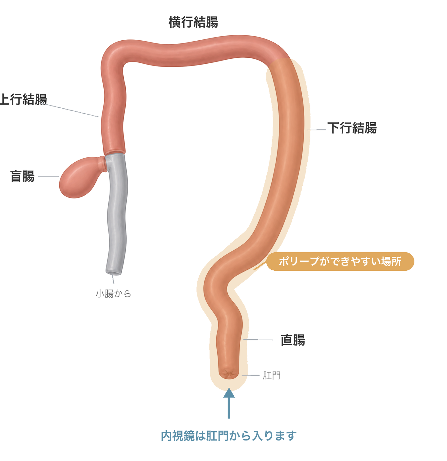 犬の大腸の図。小腸から続いて盲腸・上行結腸・横行結腸・下行結腸・直腸・肛門と並び、内視鏡は肛門から入る。ポリープは直腸から下行結腸にできやすい