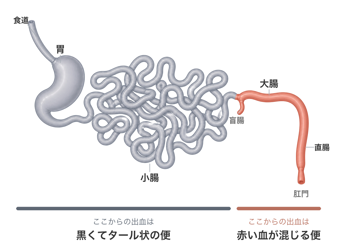 猫の消化管の全体図。出血した場所と便の見え方。